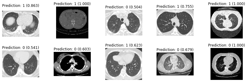 Sagemaker で Covid 19の肺ct画像を分類する Qiita