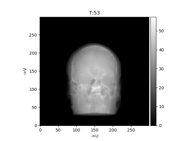 pythonとTIGREを使ったコーンビームCT（CBCT）の再構成 #Python - Qiita