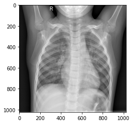 Pcrより感度が高い 深層学習を用いて胸部レントゲン画像からcovid 19を検出する Qiita